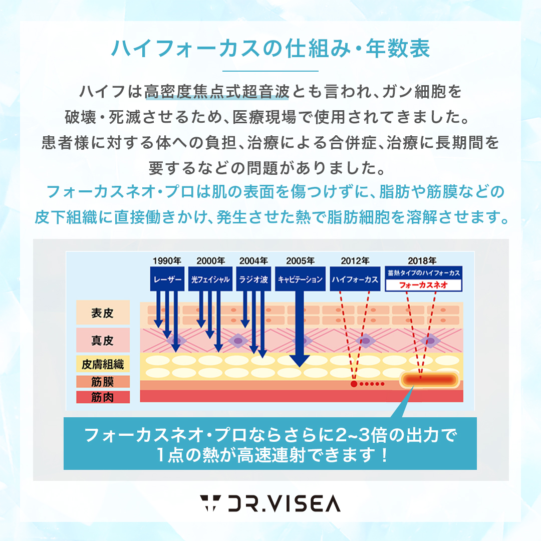 フォーカスネオの仕組み