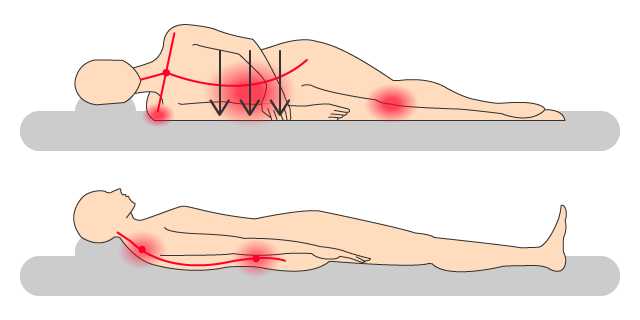 寝姿勢が悪いと体に負荷がかかる