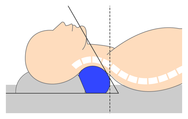 睡眠時の首の角度