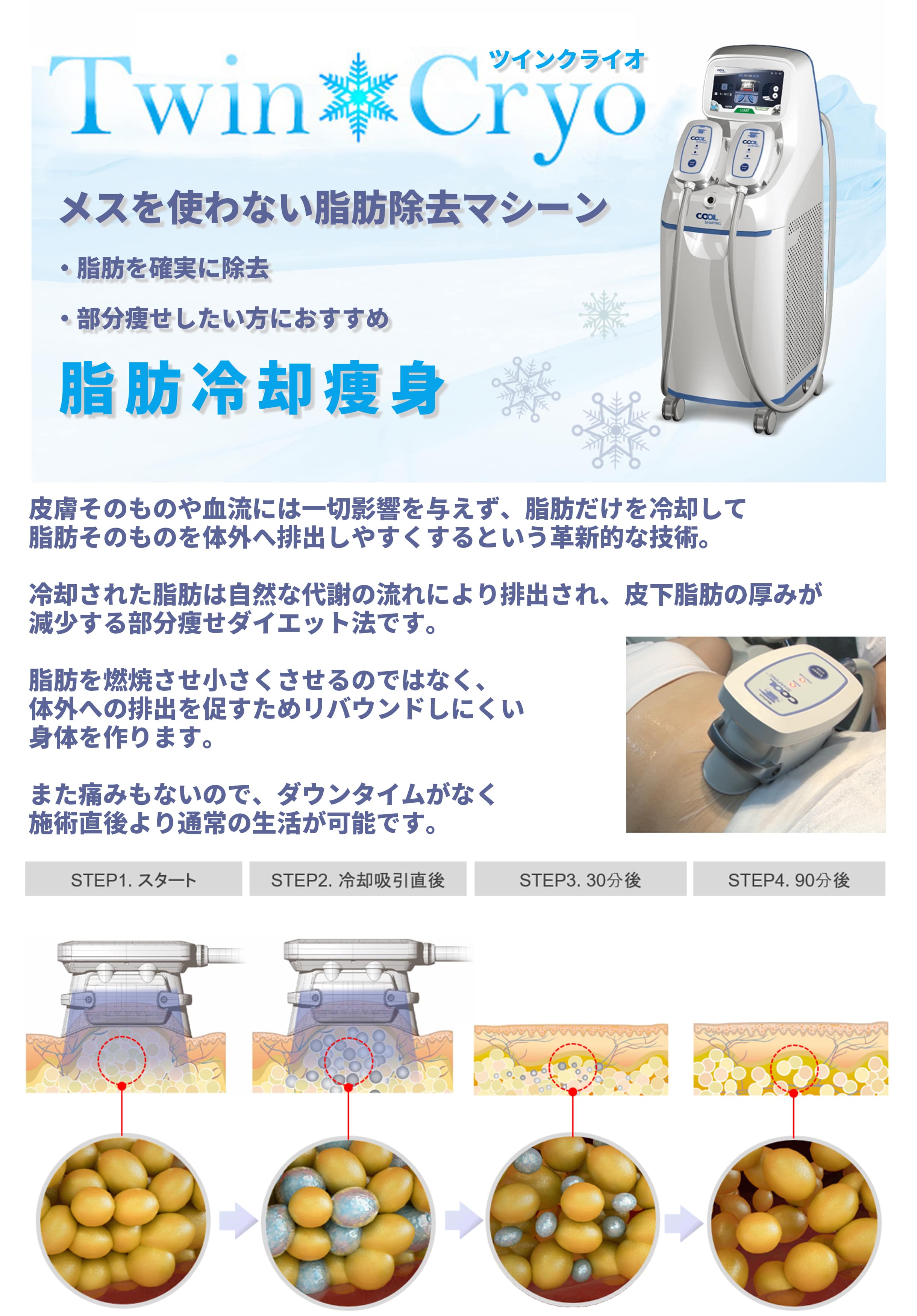 メスを使わない脂肪除去マシーン