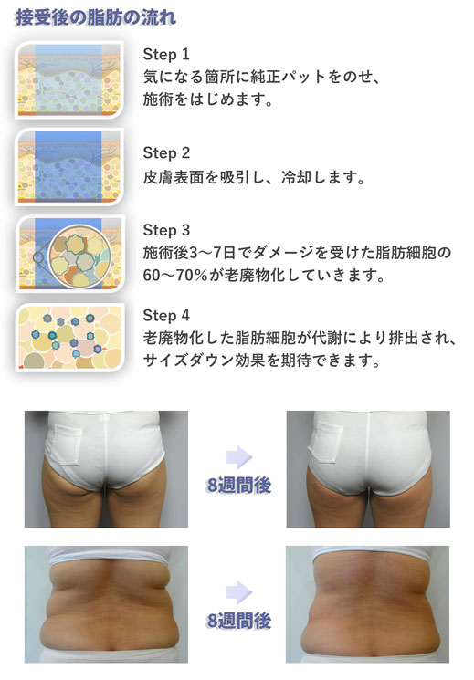 接受後の脂肪の流れ